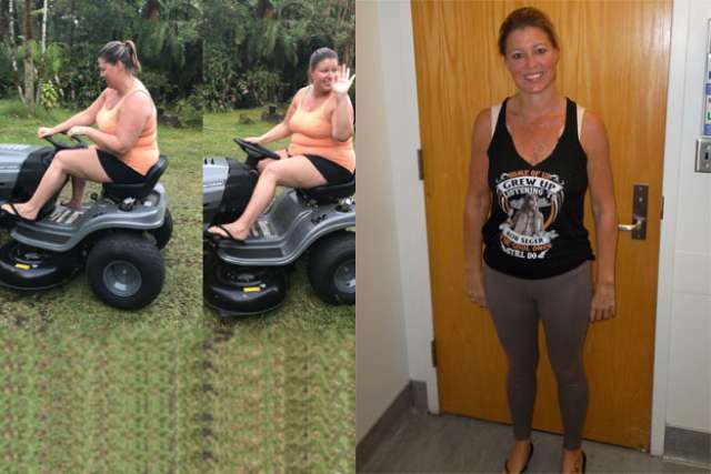 Jackie's Story - Before and After Gastric Sleeve Surgery
