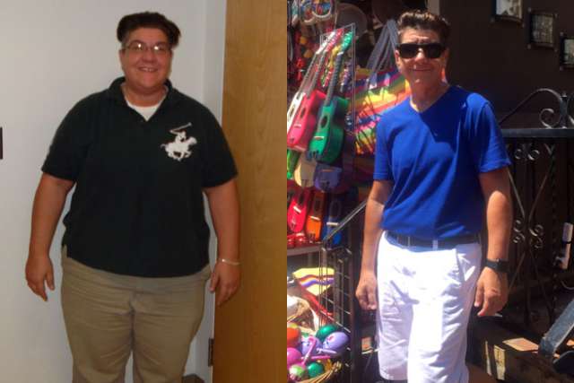 Deb's Story - Before and After Gastric Bypass Surgery
