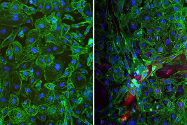 Side by side microscopy images of human stem cell-derived mini heart organoids. The left panel shows healthy, beating heart cells, while the right panel shows tissue infected with hantavirus (red), which disrupted cell structure and stopped the organoid’s heartbeat.
