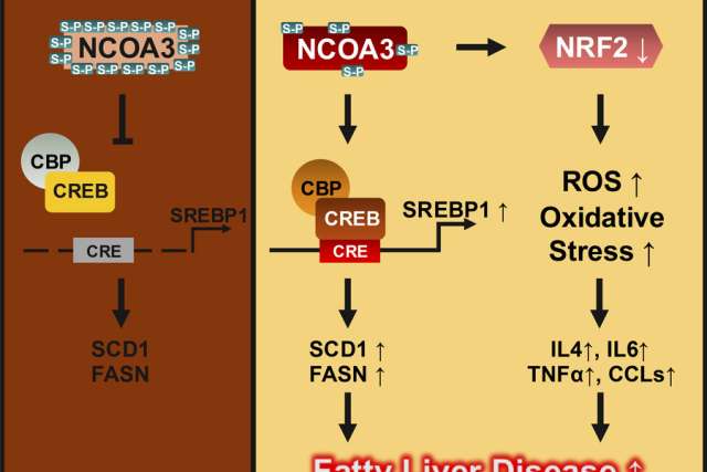 ULK1 repression linked to MASLD causing fatty liver, inflammation and fibrosis