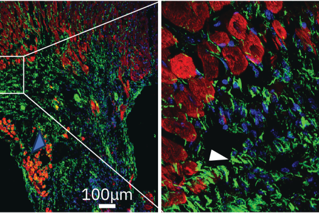 Fluorescence micrograph image of mouse heart tissue post‑heart attack: cardiac muscle in red and ENPP1 protein in green localized to scar tissue