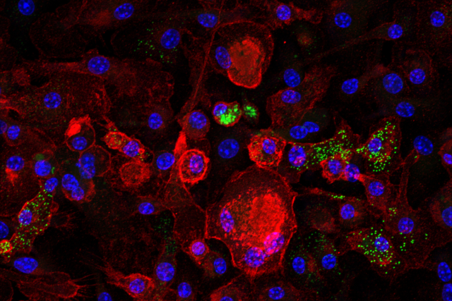 Microscopy image showing senescent macrophages in red and cholesterol-laden lipid droplets – a key driver of senescence – in green. 