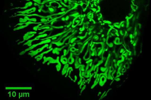 Mitochondria inside liver cells (hepatocytes)