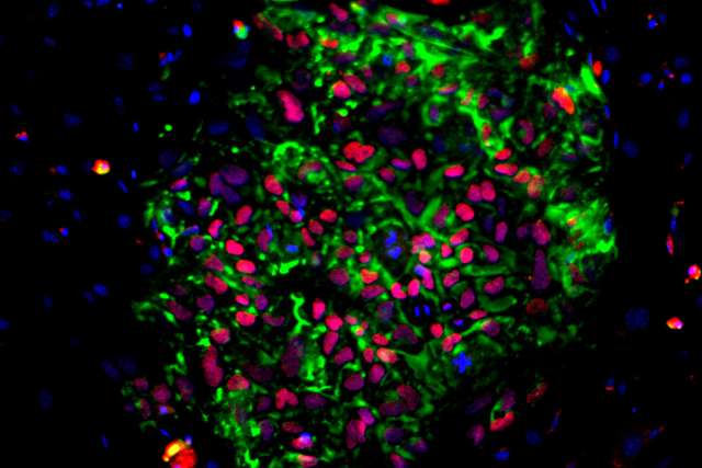 A colony of human induced pluripotent stem cells 