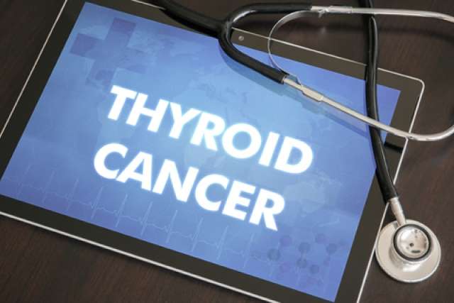 Thyroid Cancer