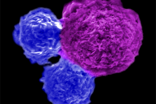  A high-resolution microscopic capture of cells. Two blue cells are attacking a purple human blood cancer cell.