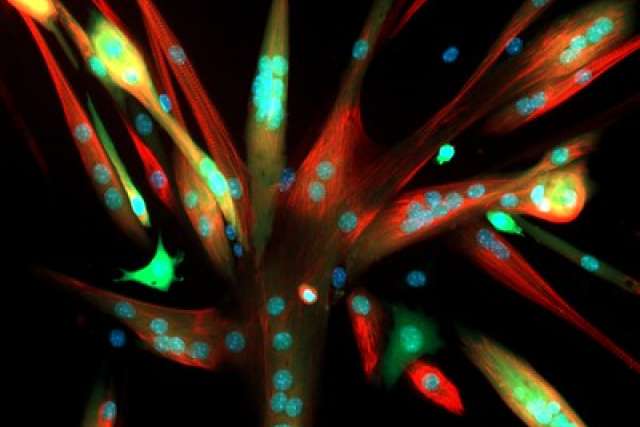 muscle cells