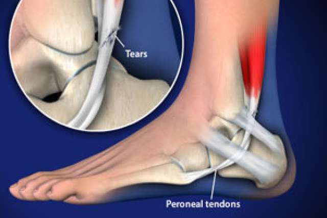 Video Library Podiatry