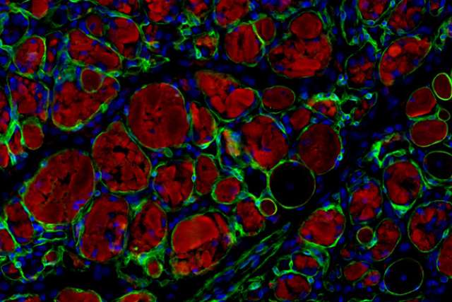 Muscle stem cells