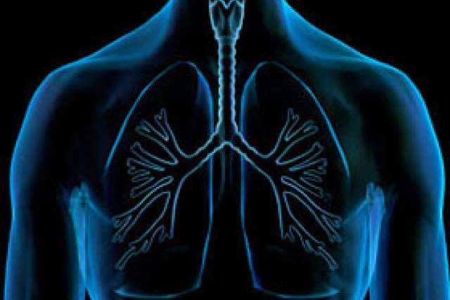 X-ray Lungs