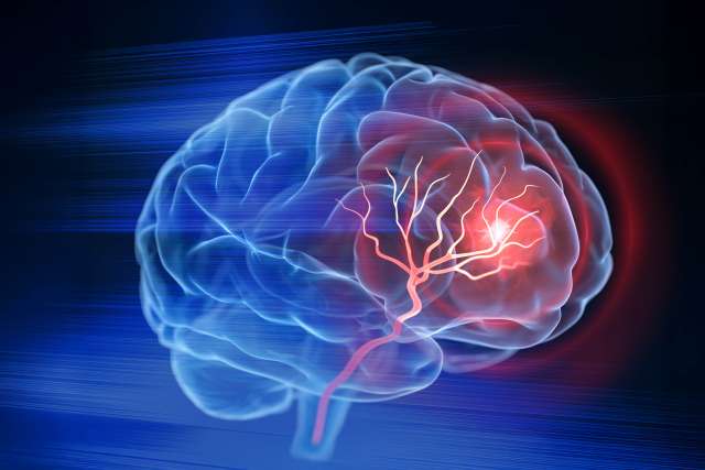 3D holographic image of a brain with tumor