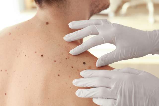 Dermatologist examining patient in clinic