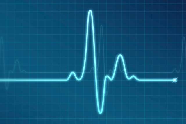EKG/Electrocardiogram