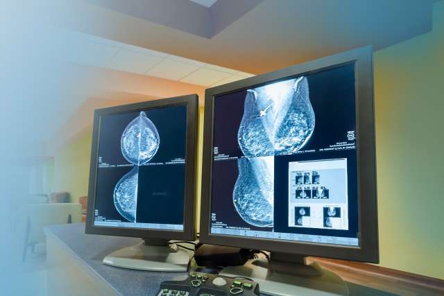 Mammogram on screen