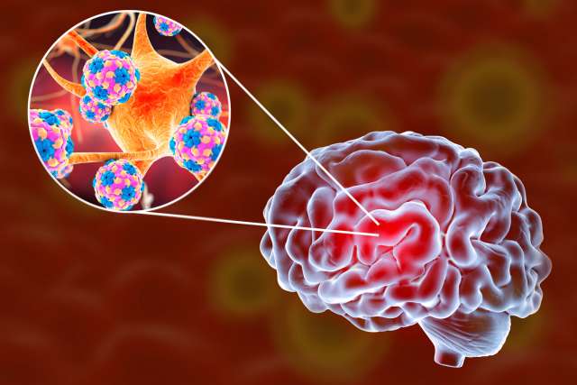 3D illustration showing brain and close-up view of viruses and neurons