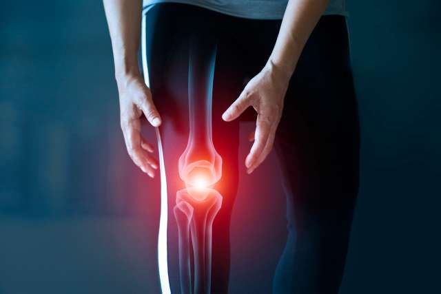 Inflamed knee joint from Rheumatoid arthritis