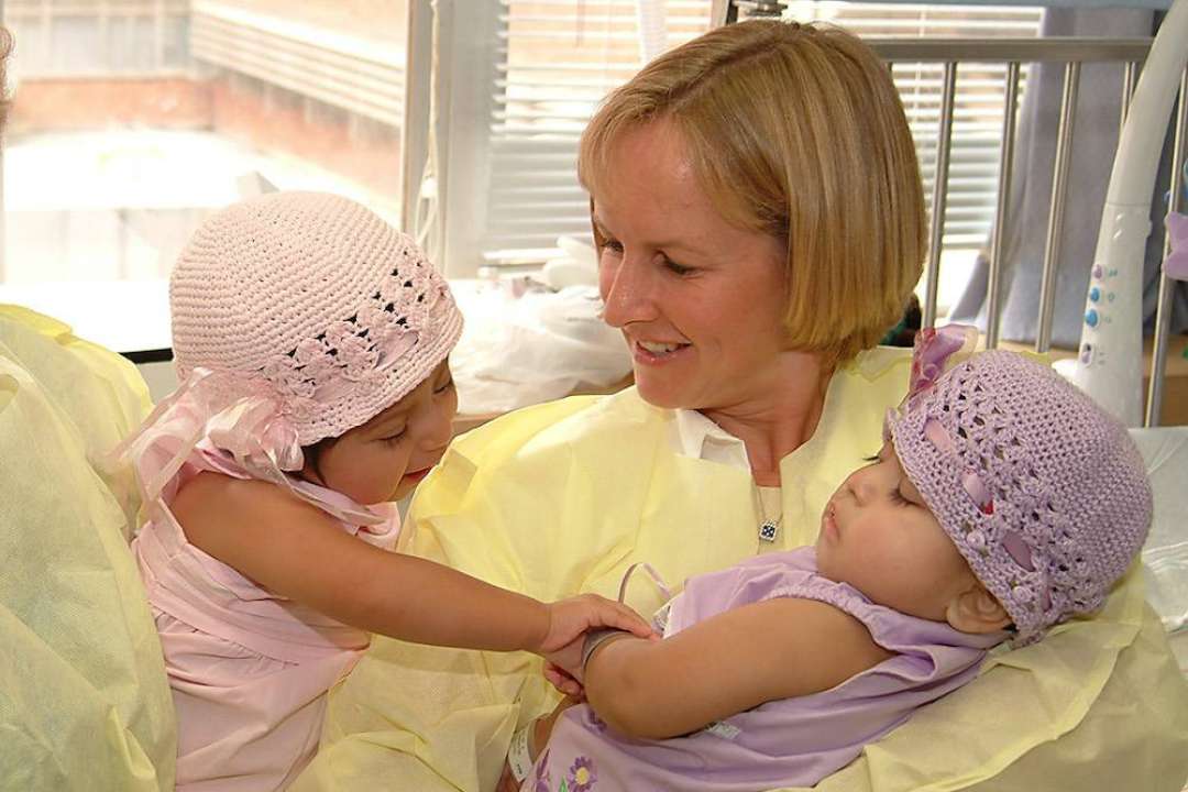 Formerly conjoined twins celebrate 21st birthday UCLA Health