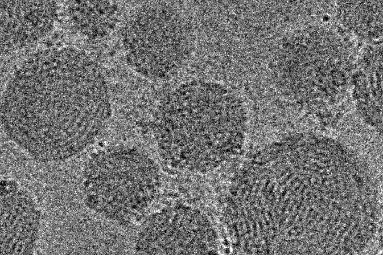 Representative cryo-TEM images of lipid nanoparticles carrying CRISPR/Cas9 gene editing components, including a Cas9-encoding mRNA, guide RNA, and a linear double stranded DNA template of the CFTR gene.