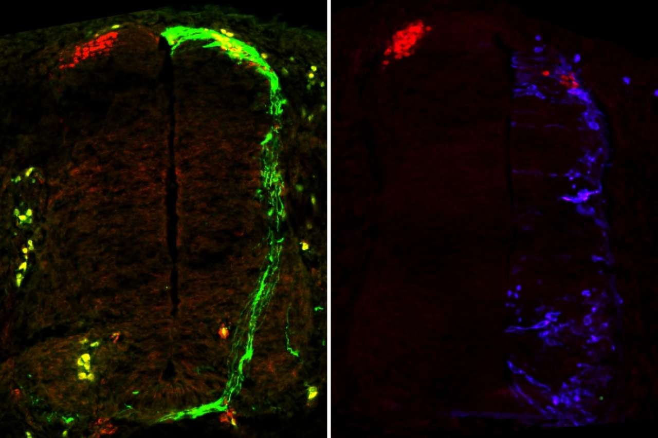 Side by side image of netrin1's impact on a spinal cord.
