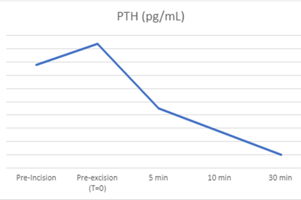 PTH Dynamics During Parathyroid Surgery