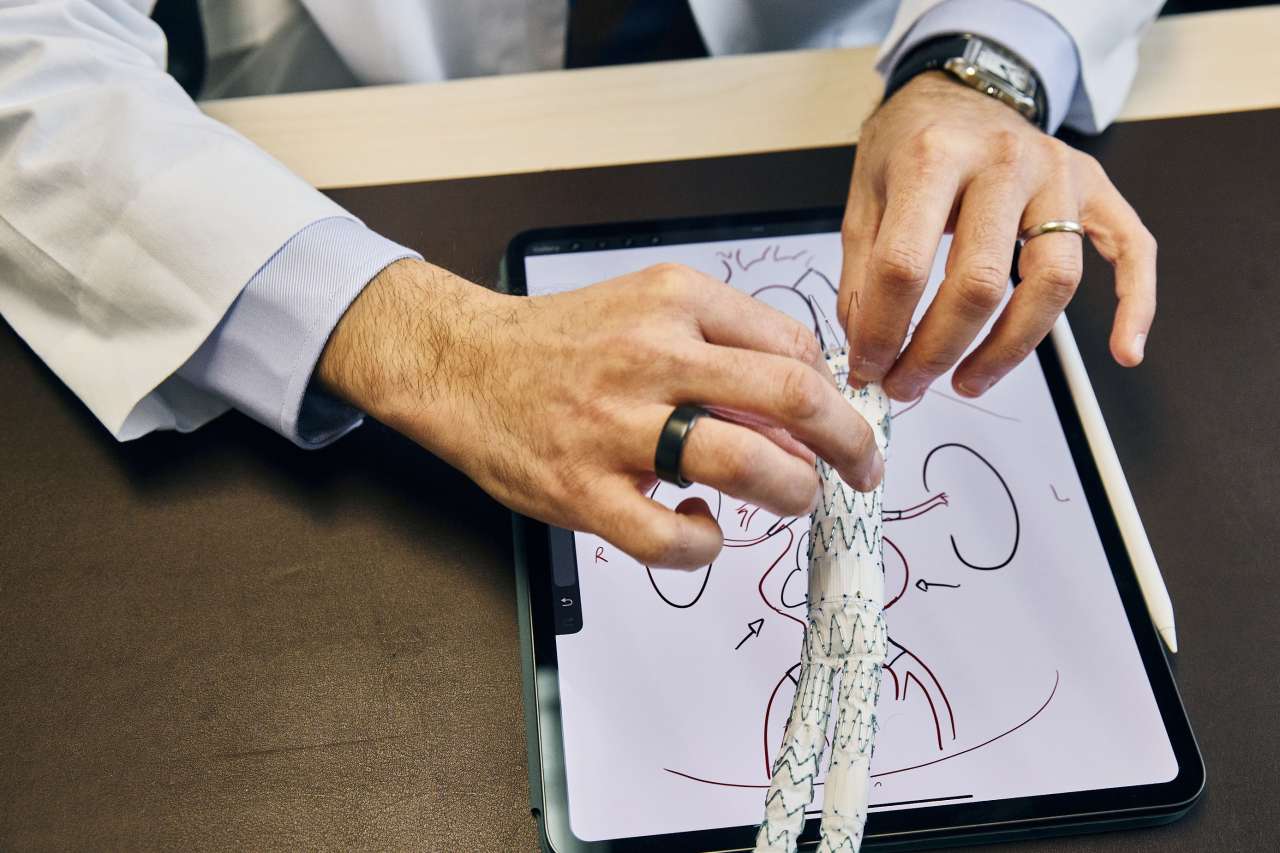 Dr. Bernardo Mendes and the stent graft.