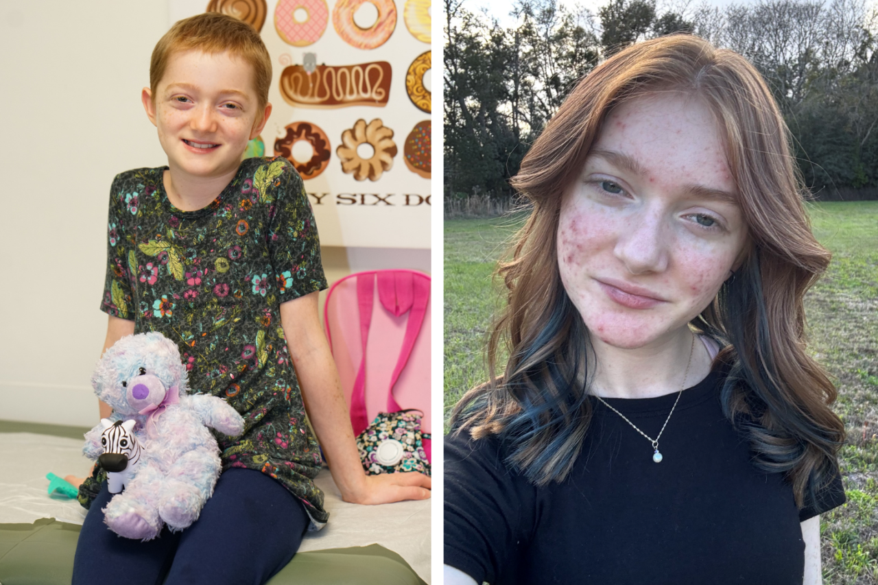 Two side-by-side images of Marley Gaskins. On the left, she is shown in a UCLA hospital room. On the right, she is older by six years and poses for a selfie. 