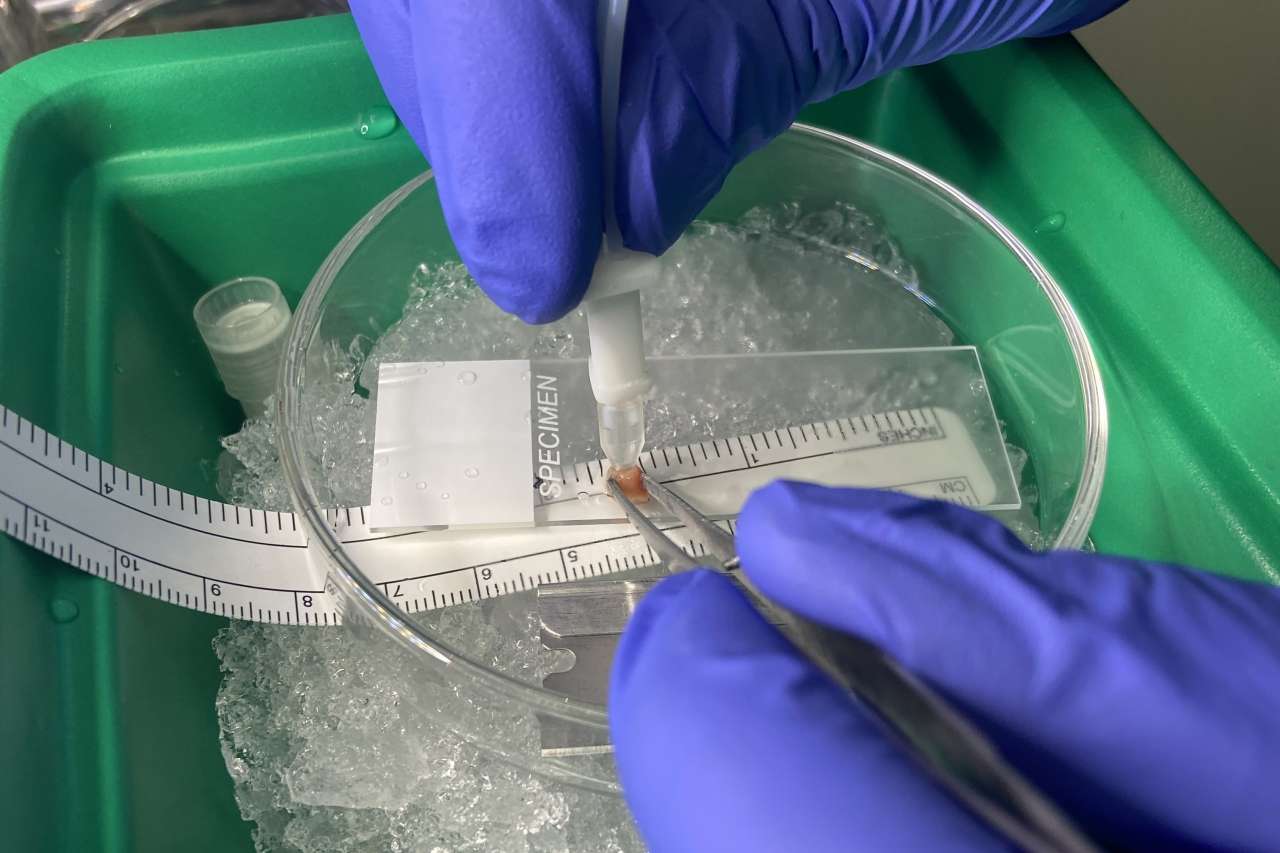 A petri dish held with gloved hands