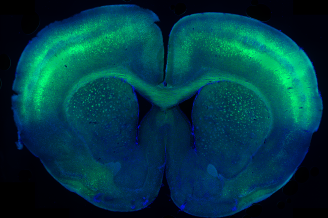 Fluorescent microscopy image of a mouse brain showing green protein used to trace how the experimental gene therapy spreads throughout the brain.