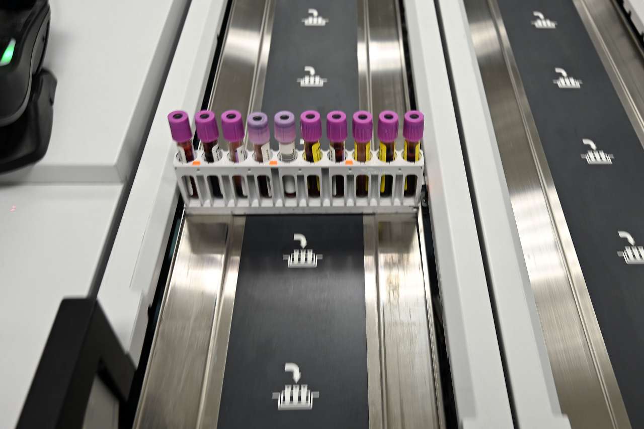 Blood test samples on a conveyor belt