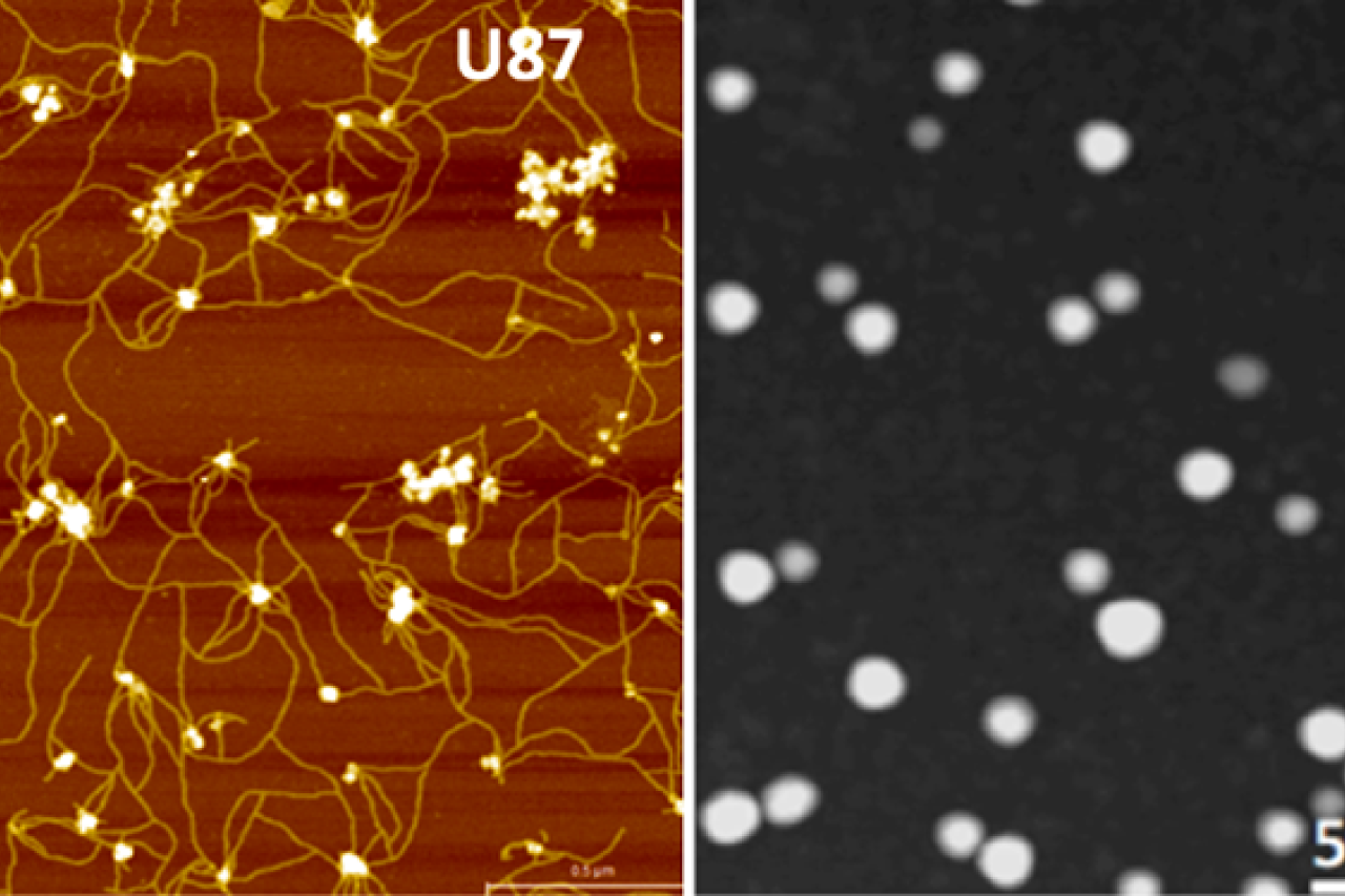 Extracellular vesicles in GBM U87 cells as imaged by atomic force microscopy