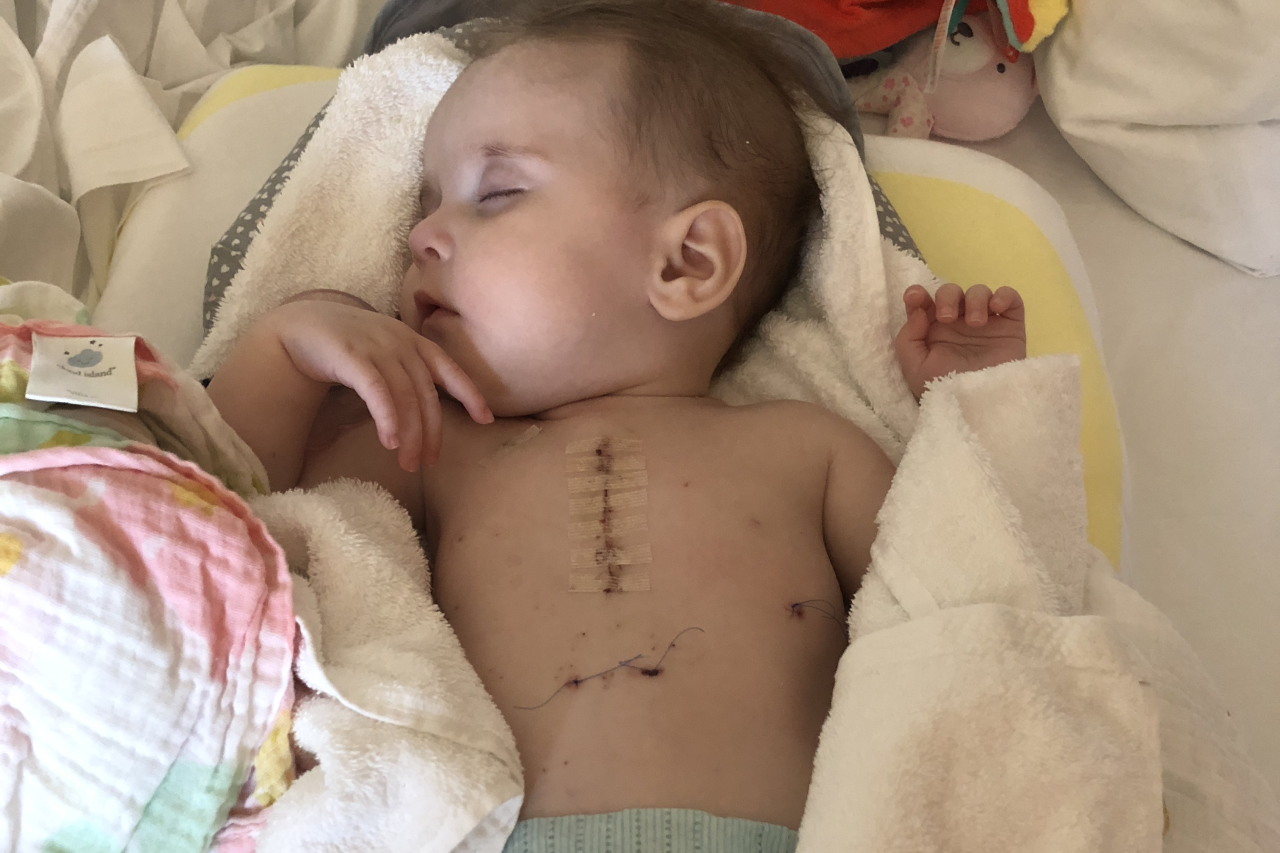 Baby Sophia sleeps in a hospital bed, recovering from heart surgery. A chest scar with stitches, blankets, and stuffed animals are visible.
