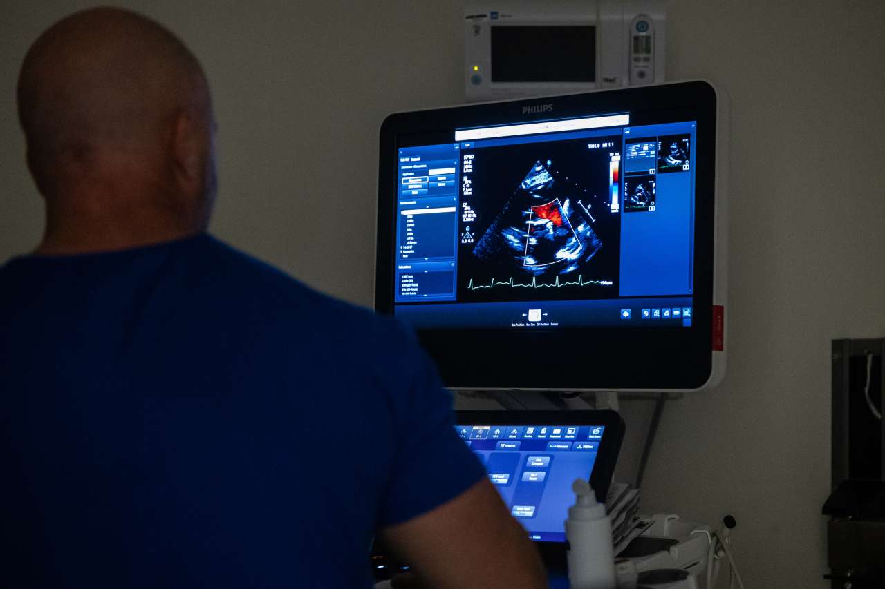 Heart scan on a machine monitor.