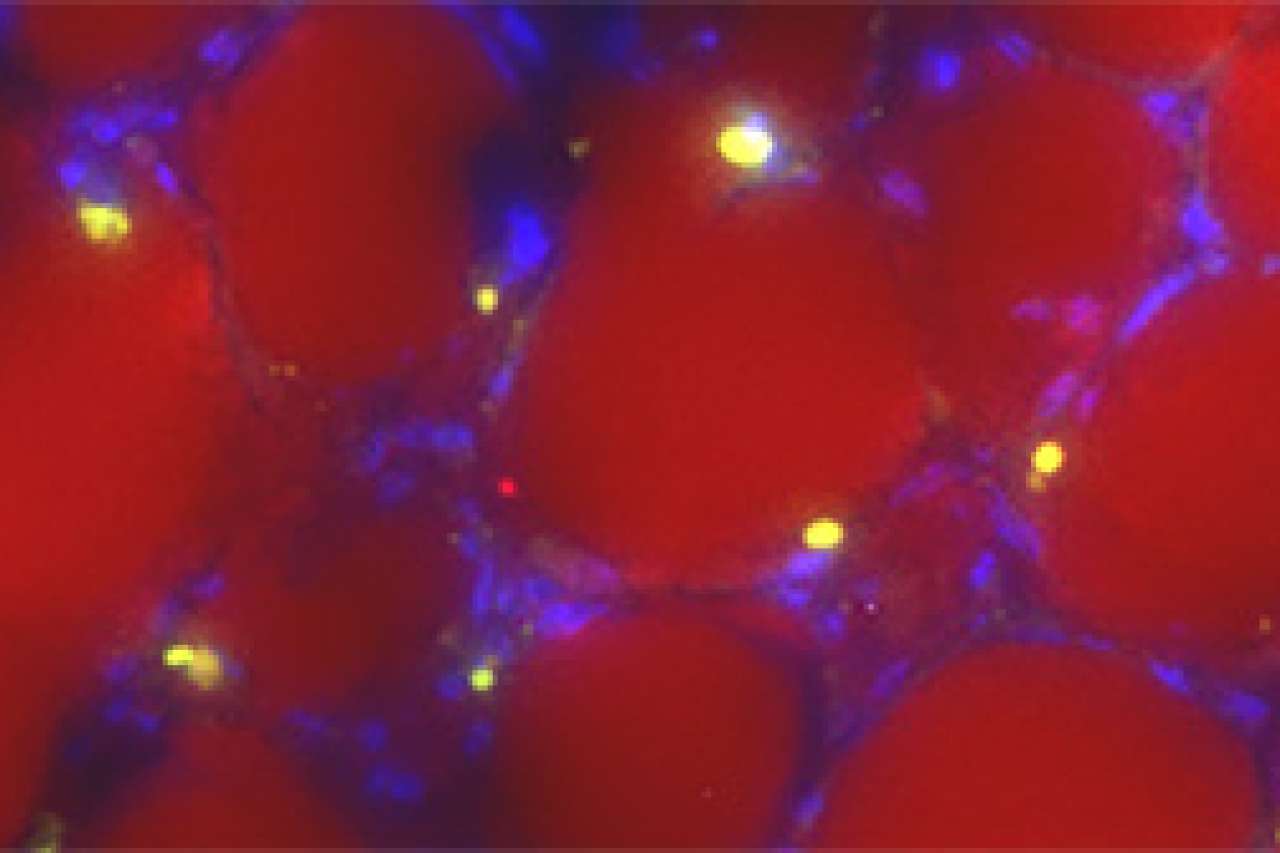 Green GFP+ ALL cells infiltrating into adipose tissue of a mouse after chemotherapy treatment