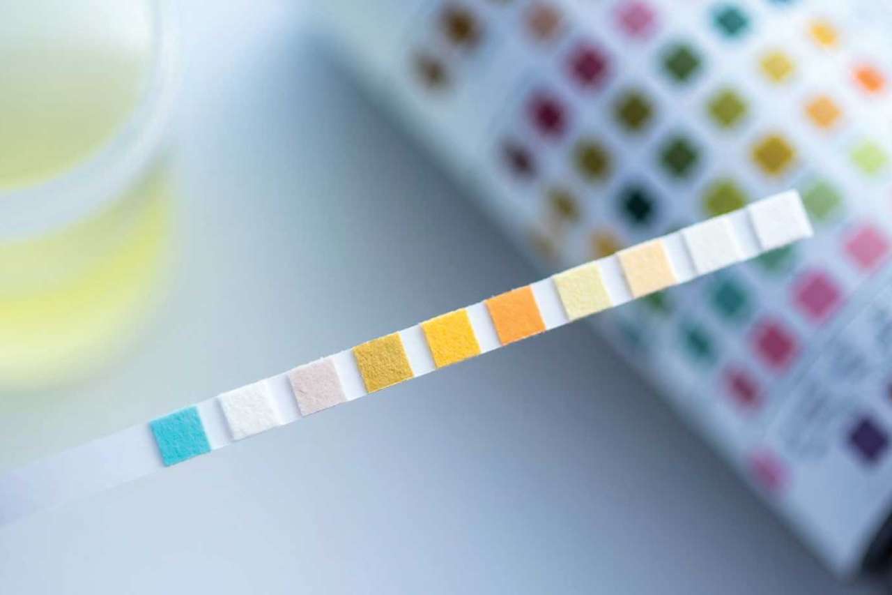 Colorful urine test