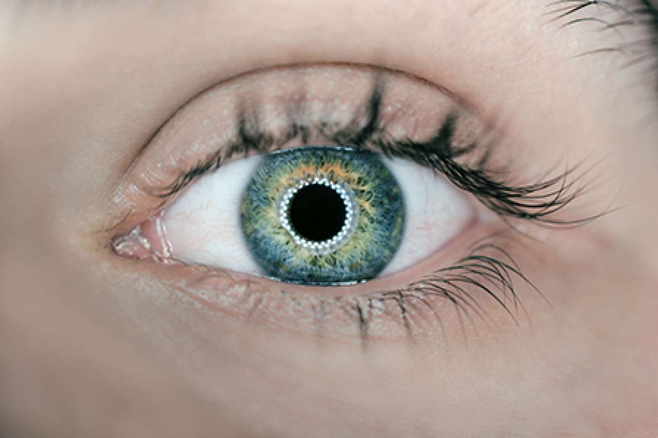 Molecular changes in cells of eye's lens predict future cataracts