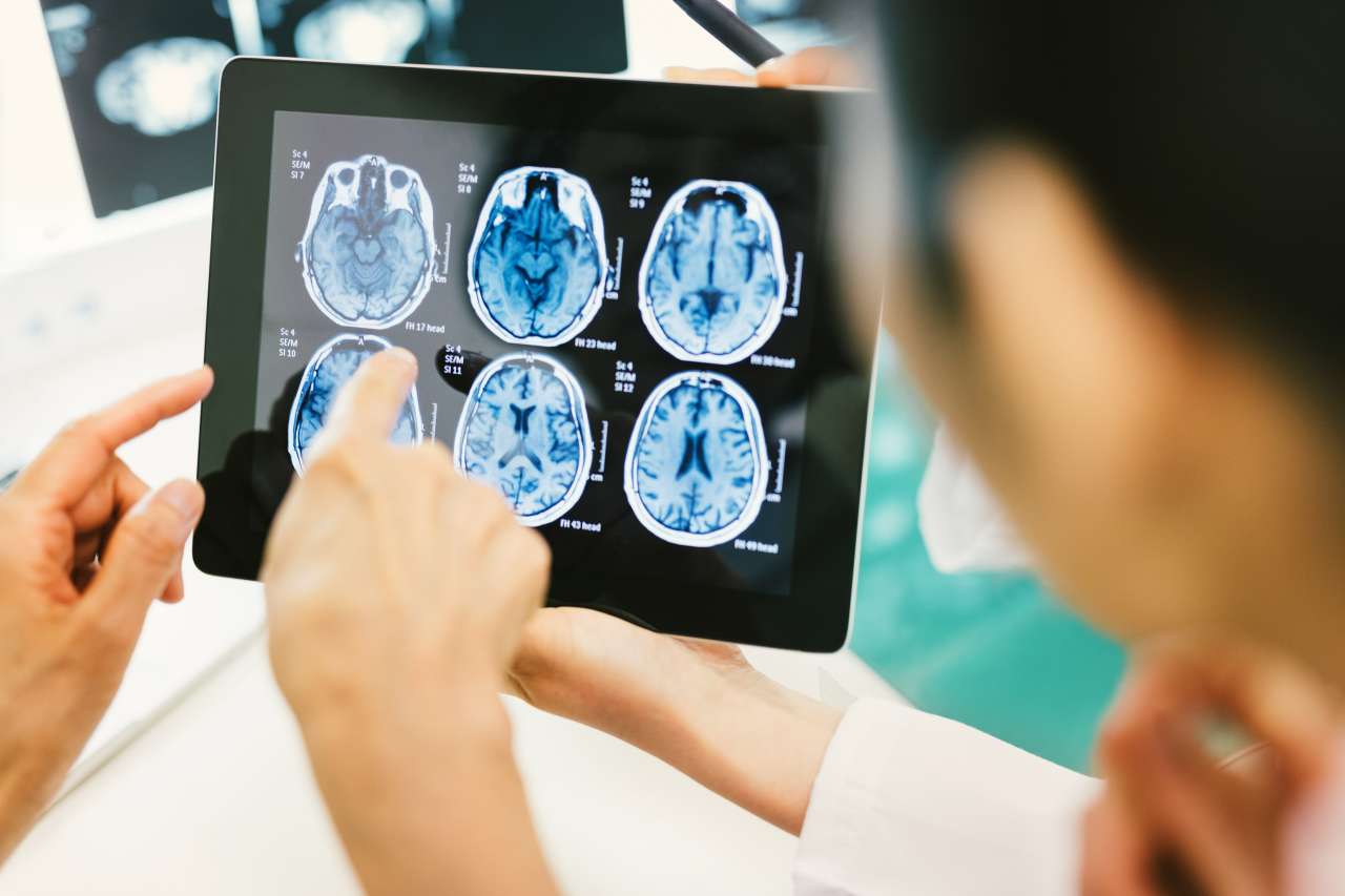 Two people reviewing brain MRI scans on a tablet, one pointing.