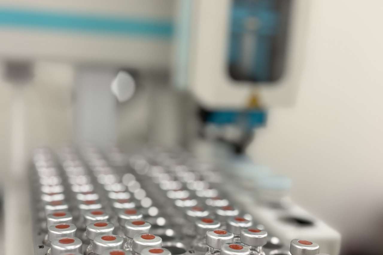 Urine samples are tested in a drug lab.