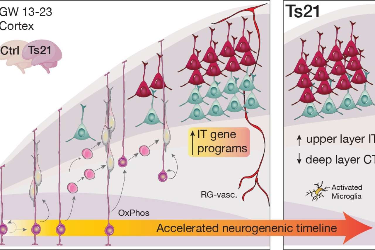 Two-panel schematic comparing Ctrl and Ts21 cortex with layered neurons and a neurogenesis timeline