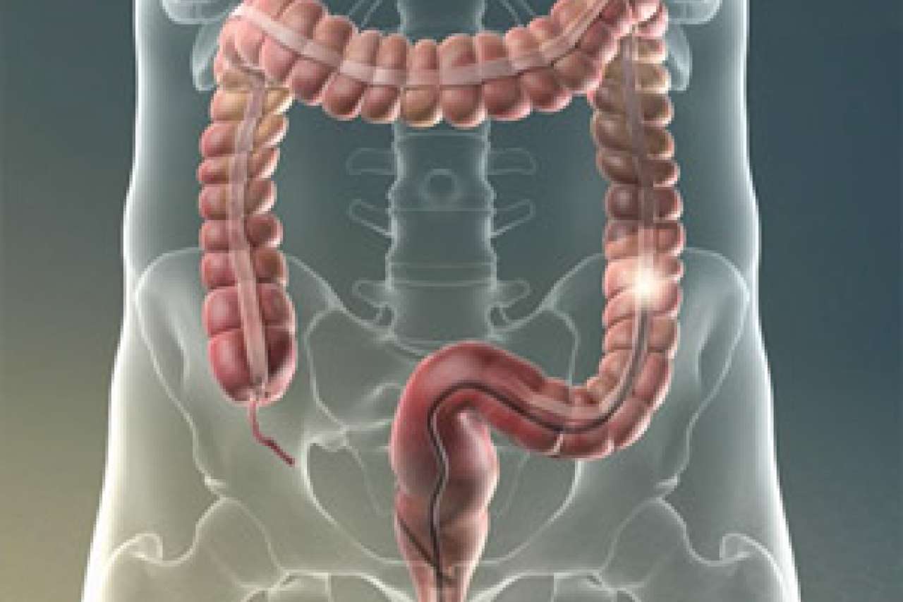 Video Library: Medical Procedures & Surgeries | UCLA Health