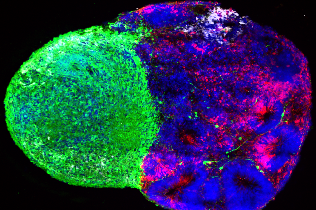Fluorescence microscopy image of two fused stem cell-derived brain organoids, with the thalamic organoid shown primarily in green and the cortical organoid in red and blue. White radial glia are visible near the top where the two tissues meet.