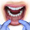 Hidden Scars after Trans-Oral Surgery