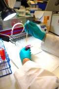 HLA and Non-HLA Antibody Testing