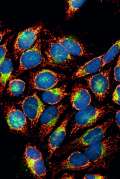 ak1 cells