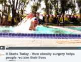 Video ASMBS Video: It Starts Today-How obesity surgery helps people reclaim their lives