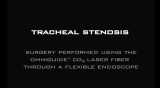 Tracheal Stenosis Video Preview