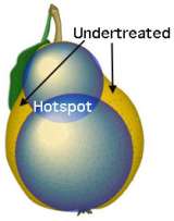 Illustration uses a pear to demonstrate the difficulty in obtaining conformal radiation planning using spherical targeting