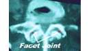 X-ray [CT scan] showing the facet joint in cross-section