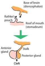 Illustration of Rathke's Cleft Cyst