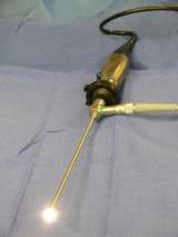 Image of endoscope