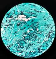 Aspergillus photo by JR Caldera